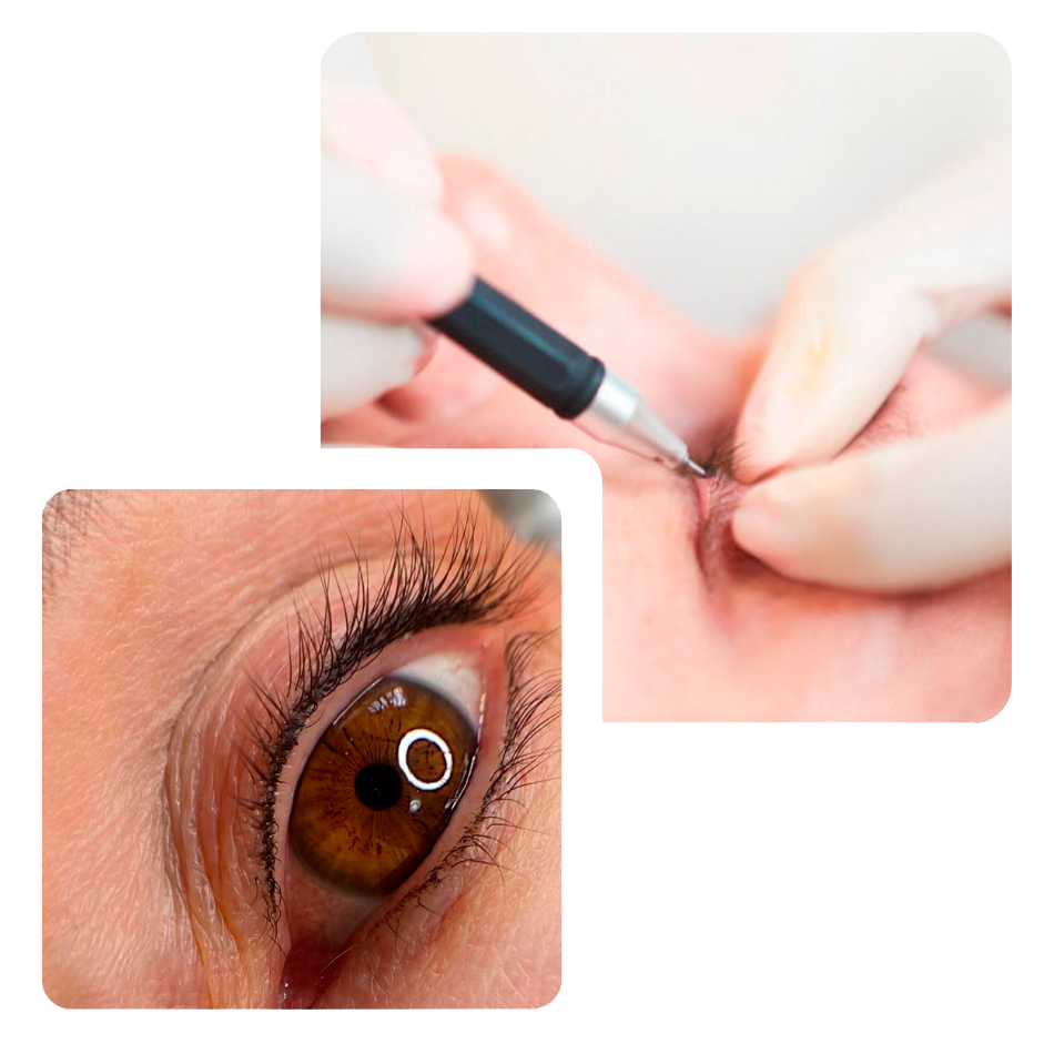 Micropigmentación de ojos con la técnica entrepestañas